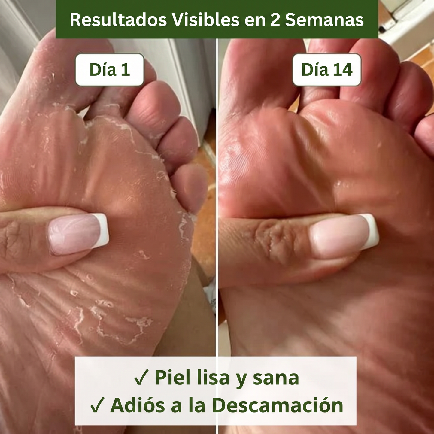 Jabón Anti-Hongos Ritualis Lab