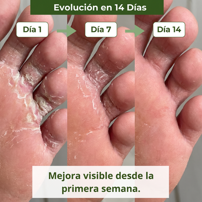 Jabón Anti-Hongos Ritualis Lab